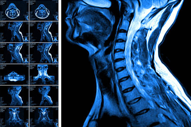 mri smith family chiropractic